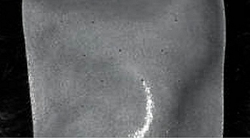 Parrucche e protesi di capelli umani dell'Azienda Meditoupee